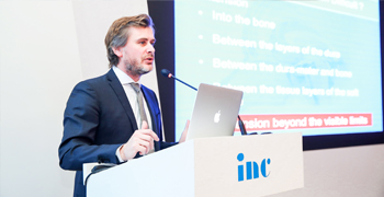 國際治療腦瘤醫生哪個好